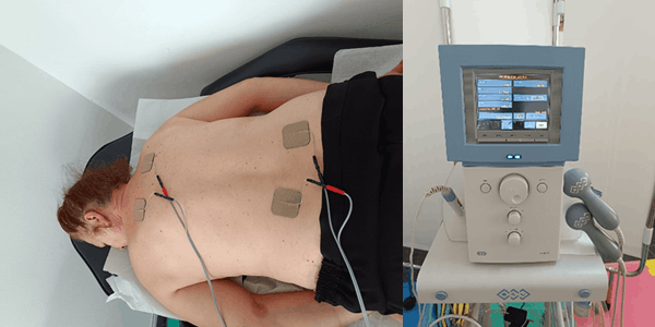 Electroterapia